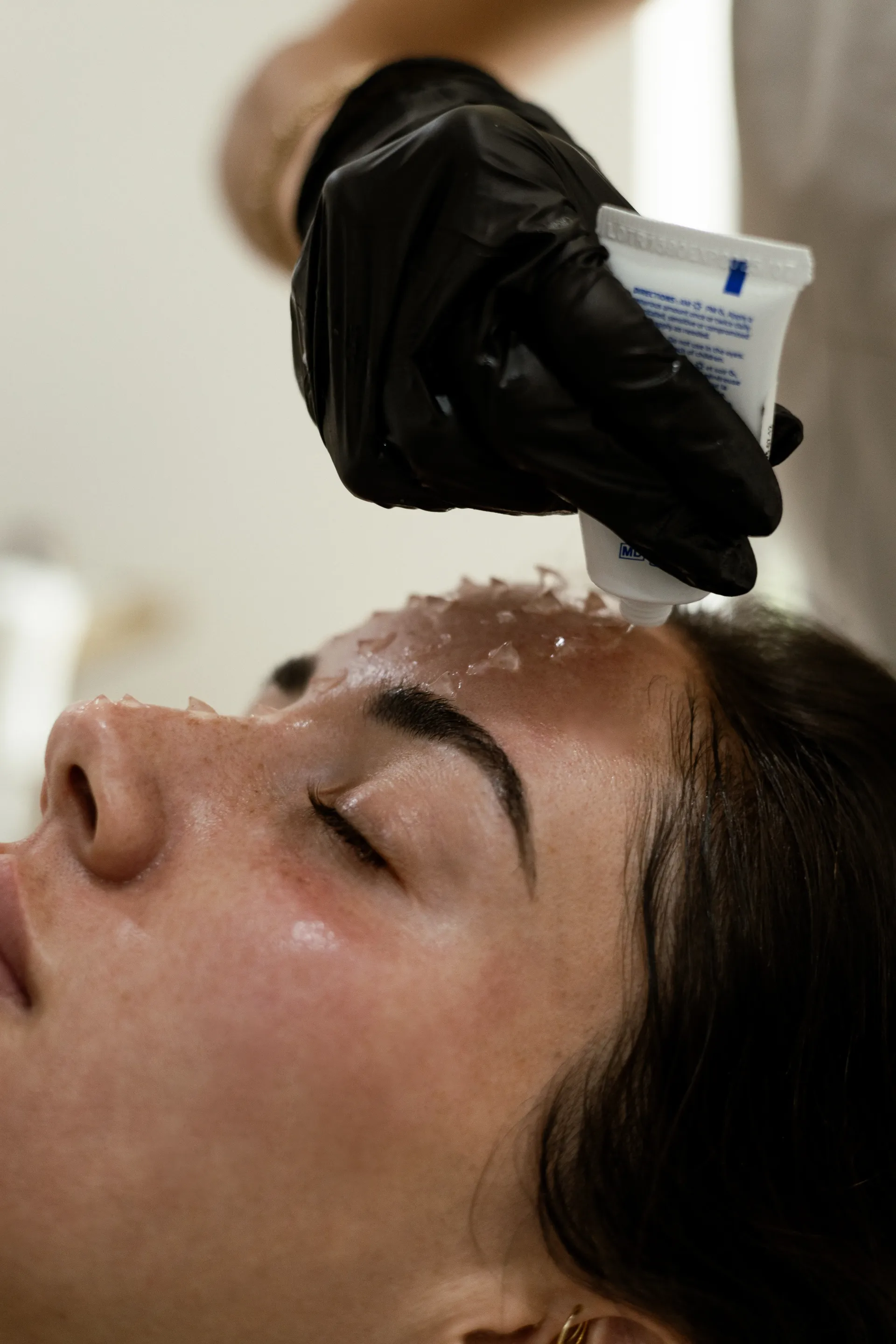 Red Carpet Facial Denver: Cost, Downtime, and What to Expect