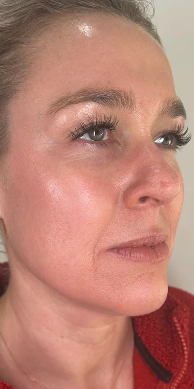 After: Comprehensive regimen for radiant, healthy skin